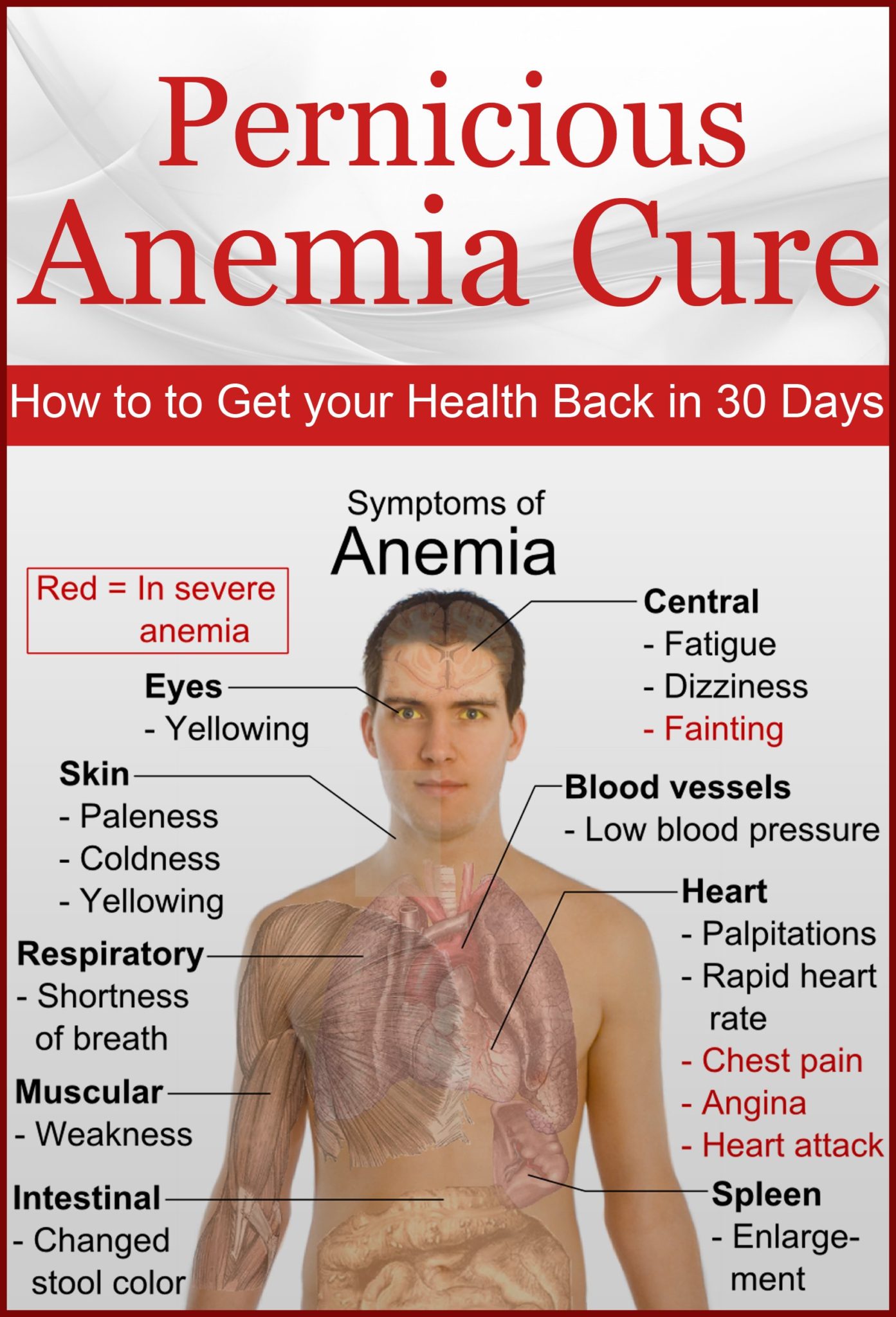 FREE: Pernicious Anemia Cure: How to Get Your Health Back in 30 Days (anemia,anemia symptoms,immune system,iron deficiency anemia,what is anemia) by Mary Bux