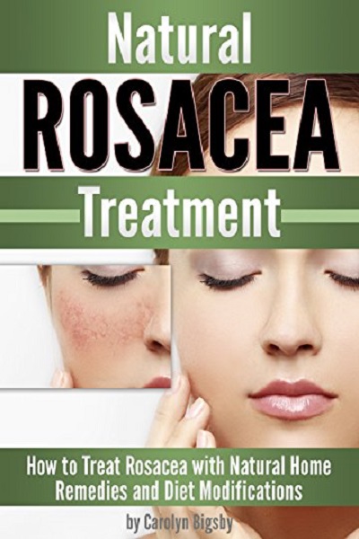 FREE: Natural Rosacea Treatment: How to Treat Rosacea with Natural Home Remedies and Diet Modifications by Carolyn Bigsby